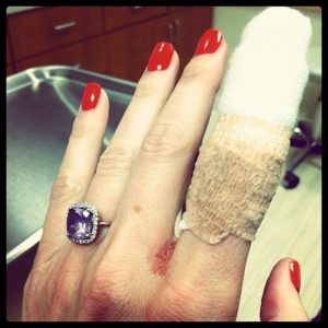 and then I cut my finger off